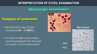 Interpretation of Stool Examination [upl. by Ialohcin]