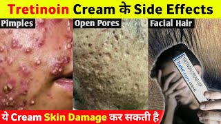 Tretinoin Cream के ये Side Effects आप नहीं जानते होगे 😱 [upl. by Sorrows206]