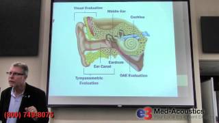 Auditory Evoked Potentials  OtoAcoustic Emissions OAE [upl. by Hairahcez]