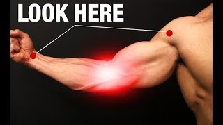 How to Fix Elbow Pain ONE SIMPLE EXERCISE [upl. by Hervey257]