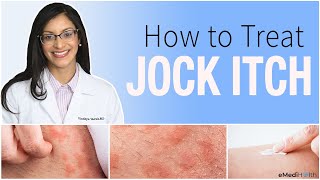 Jock Itch Treatment Prevention Causes and Home Care Tips [upl. by Syxela]