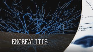 ENCEFALITIS [upl. by Razec]