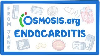 Clinicians Corner Endocarditis [upl. by Ulu]