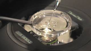 The Process of Intracytoplasmic Sperm Injection for IVF [upl. by Bernice]