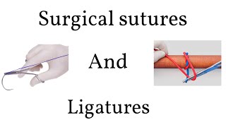 Pulmonary Artery Swan Ganz Catheter Insertion [upl. by Eiramac400]