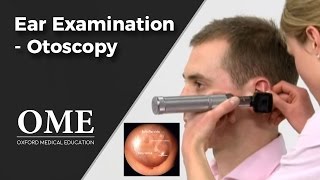 Otoscopy Ear Examination  ENT [upl. by Wertz]