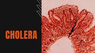 What is Cholera Causes Symptoms Transmission and Treatment [upl. by Cordeelia]