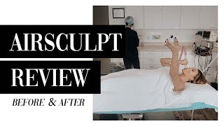 5Month Airsculpt Review  Before amp After [upl. by Ardie]