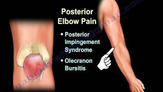 ELBOW PAIN  COMMON CAUSES  Everything You Need To Know  Dr Nabil Ebraheim [upl. by Kemeny391]