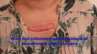 Chest Keloids  Mistakes to Avoid [upl. by Tansey]