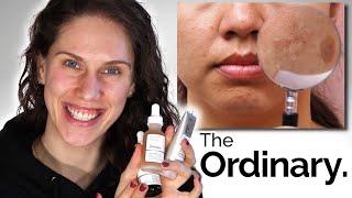 THE ORDINARY  3 BEST DARK SPOTS amp PIGMENTATION PRODUCTS [upl. by Repsihw]