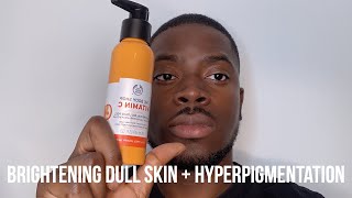 HOW I GOT RID OF DARK SPOTS BRIGHTEN DULL SKIN  HYPERPIGMENTATION [upl. by Eileen]