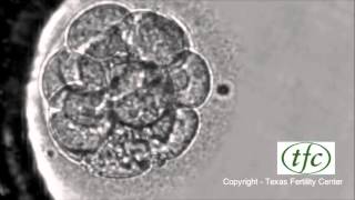 Human Embryo Growing from Fertilization to Day 6 Blastocyst [upl. by Mandelbaum]