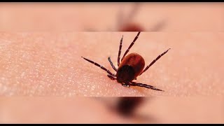 Lyme Disease Treatment  Johns Hopkins 4 of 5 [upl. by Eldreda]