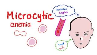 Microcytic Anemia introduction [upl. by Eylsel]