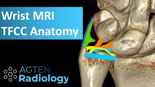 MRI Anatomy of TFCC [upl. by Brause]