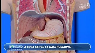 Il mio medico  Gastroscopia quando farla [upl. by Gregg46]