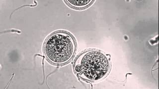 Interacting sperm and egg [upl. by Anoyi]