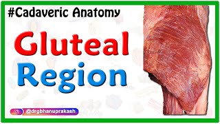 Gluteal region  Cadaveric Anatomy [upl. by Herzig]