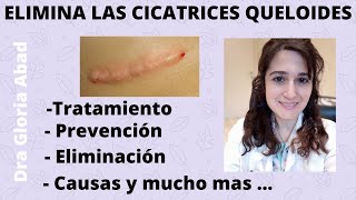 CICATRICES QUELOIDES ▶ Causas prevención y tratamientos ✅ [upl. by Heidi]