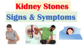 Kidney Stones Nephrolithiasis Signs amp Symptoms  amp Why They Occur [upl. by Olegnaed]