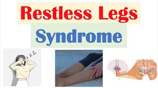 Restless Legs Syndrome RLS  Causes Signs amp Symptoms Diagnosis Treatment [upl. by Zela]