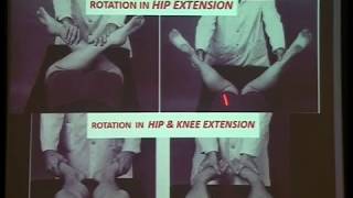 Gopalan Examination of the Hip Joint [upl. by Stroud]