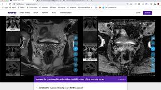 MRI PRO Prostate MRI Training Course  Tutorial [upl. by Gemma]