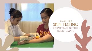 Intradermal InjectionSkin testing using Tomato [upl. by Aicemaj601]