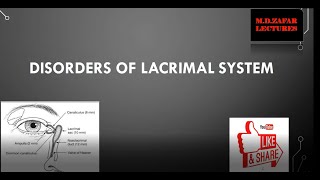 Lacrimal System Disorders [upl. by Pironi35]