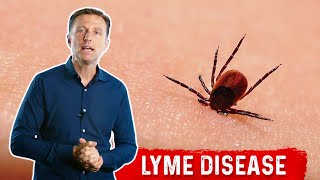 Do you know the signs of Lyme disease [upl. by Yleoj]