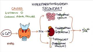 Understanding Hyperparathyroidism [upl. by Pitarys]