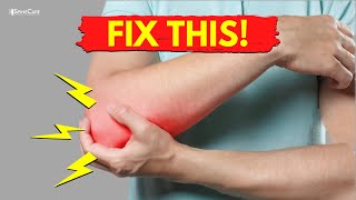 How to Fix Elbow Popping Sounds in 30 SECONDS [upl. by Scrivenor757]