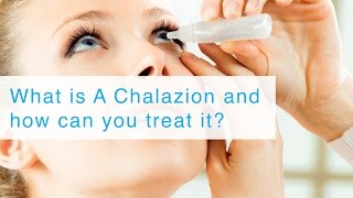 What is A Chalazion and how can you treat it [upl. by Tijnar]