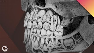 Where Do Teeth Come From [upl. by Jonathon]