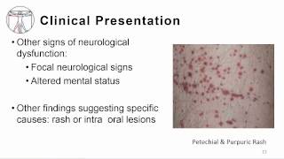 1 Overview meningitis and encephalitis [upl. by Metzger]