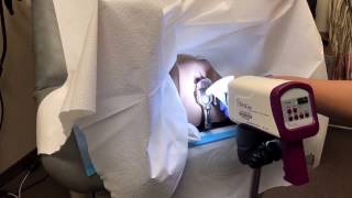 Colposcopy training video [upl. by Tomasina]