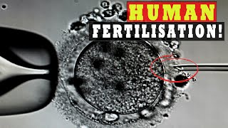 Human Sperm and Egg Fertilization Microscope  IVF ICSI Procedure [upl. by Moule786]