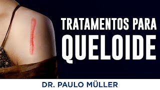 Tratamentos para Queloide – Dr Paulo Müller Dermatologista [upl. by Doownelg]