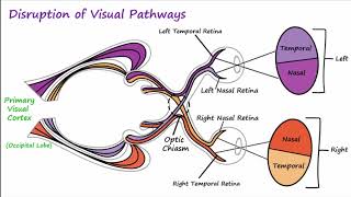 Visual Neural Pathways and Visual Field Defects [upl. by Imojean]