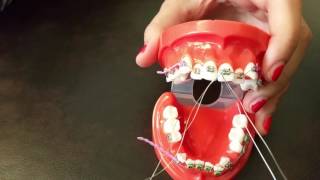 Placing a stainless steel ligature wire for Braces [upl. by Wernher]