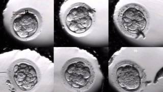 IVF PROCESS STEP BY STEP In Vitro Fertilisation Embryo cultivation [upl. by Heimlich]