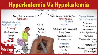 Hyperkalemia Vs Hypokalemia  EASY TO REMEMBER [upl. by Enirak]