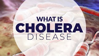 WHAT IS CHOLERA DISEASE [upl. by Cynara]