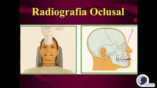 Radiografia Oclusal  Radiodoc [upl. by Eduard]