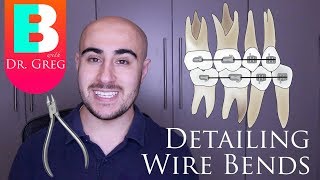 BRACES EXPLAINED Detailing Wire Bends [upl. by Attiuqihc]