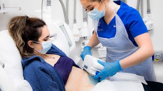 Fat Freezing  What to Expect From a CoolSculpting Treatment [upl. by Eibrab642]